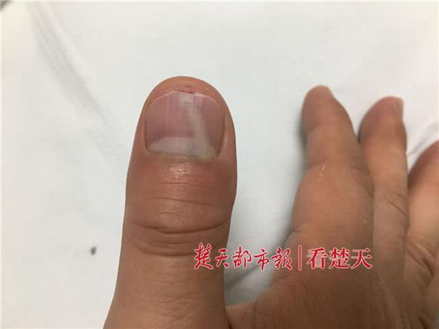 副本：义体置换